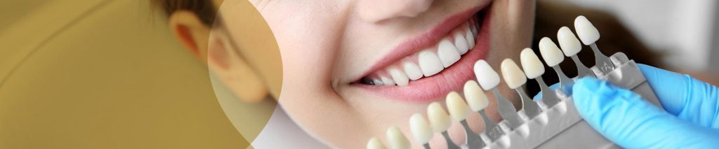 Woman smiling while dentist chooses shade of veneer.