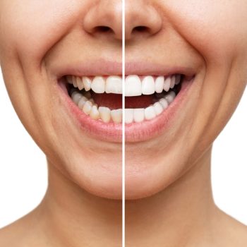 cosmetic dentistry near you