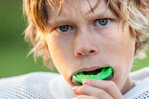Boy preparing to wear a green mouthguard, emphasizing the importance of dental protection during sports activities.